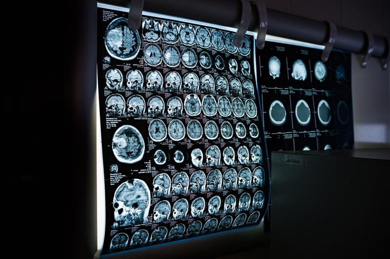 Body Scan Image